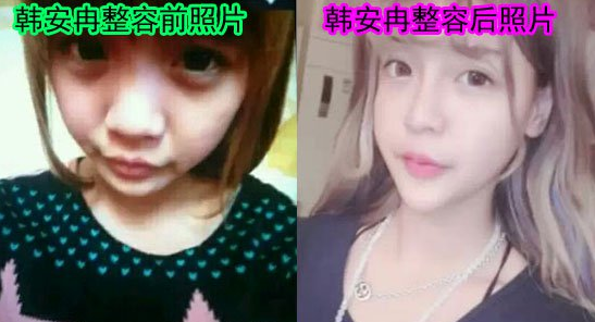 韩安冉整容前后照片,韩安冉整容前是什么样子的