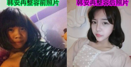韩安冉整容前后照片,韩安冉整容前是什么样子的